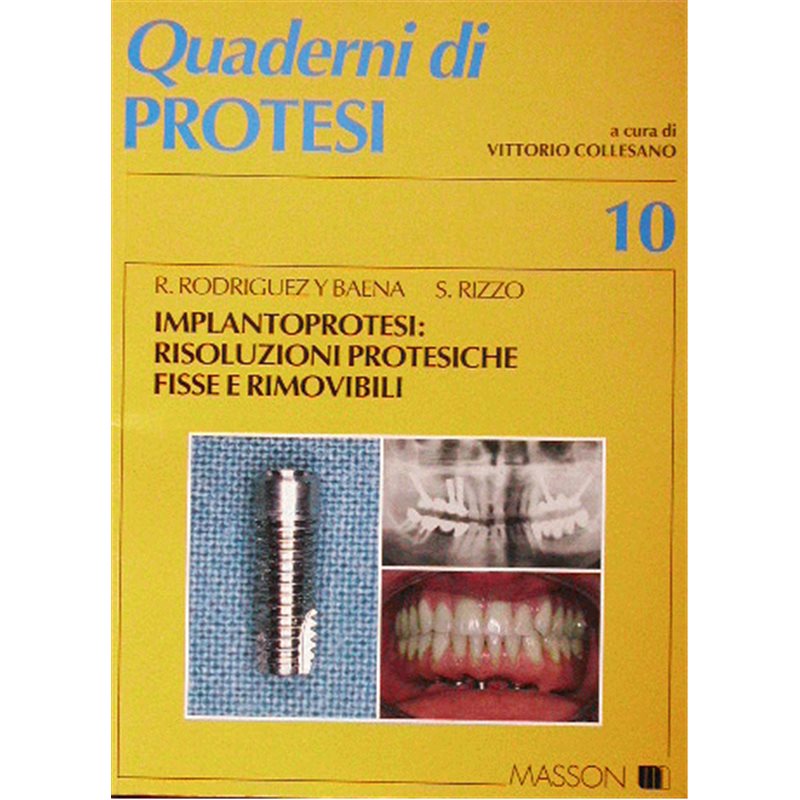 Quaderni di Protesi - 10 - Implantoprotesi: risoluzioni protesiche fisse e rimovibili